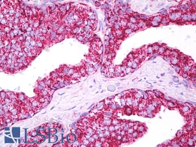 Anti-TSPO / PBR antibody IHC of human prostate. Immunohistochemistry of formalin-fixed, paraffin-embedded tissue after heat-induced antigen retrieval. Antibody LS-B7511 dilution 1:50.
