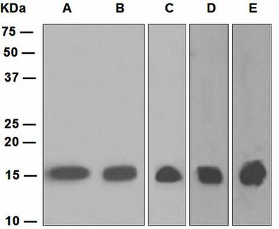 Western blot analysis on (A) U87-MG, (B) 293T, (C) A431, (D) Raw264.7, and (E) NIH/3T3 cell lysates using anti-TSPO antibody.