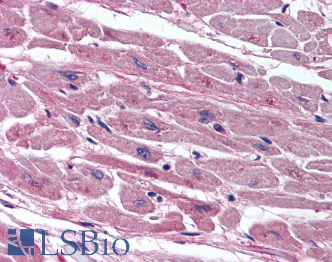 Anti-TSPO / PBR antibody IHC of human heart. Immunohistochemistry of formalin-fixed, paraffin-embedded tissue after heat-induced antigen retrieval. Antibody LS-B2120 concentration 5 ug/ml.
