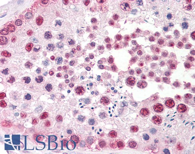 Anti-TSPY1 / TSPY antibody IHC staining of human testis. Immunohistochemistry of formalin-fixed, paraffin-embedded tissue after heat-induced antigen retrieval.