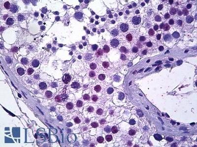 Anti-TSPYL2 antibody IHC of human testis. Immunohistochemistry of formalin-fixed, paraffin-embedded tissue after heat-induced antigen retrieval. Antibody LS-B5906 concentration 5 ug/ml.