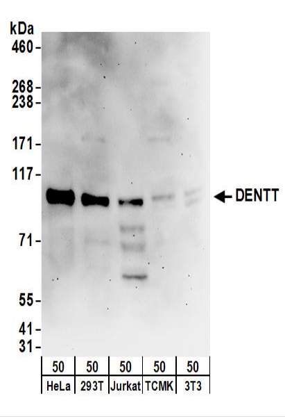 Detection of Human DENTT by Western Blot. Samples: Whole cell lysate (50 ug) from HeLa, 293T, Jurkat, mouse TCMK-1, and mouse NIH3T3 cells. Antibodies: Affinity purified rabbit anti-DENTT antibody used for WB at 0.4 ug/ml. Detection: Chemiluminescence with an exposure time of 3 minutes.