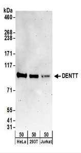 Detection of Human DENTT by Western Blot. Samples: Whole cell lysate (50 ug) from HeLa, 293T, Jurkat cells. Antibodies: Affinity purified rabbit anti-DENTT antibody used for WB at 0.4 ug/ml. Detection: Chemiluminescence with an exposure time of 3 minutes.