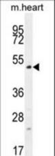TSPYL4 Antibody western blot of mouse heart tissue lysates (35 ug/lane). The TSPYL4 antibody detected the TSPYL4 protein (arrow).