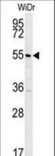 TSPYL4 Antibody western blot of WiDr cell line lysates (35 ug/lane). The TSPYL4 antibody detected the TSPYL4 protein (arrow).