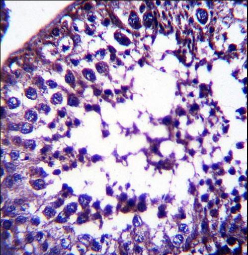 TSPYL5 Antibody immunohistochemistry of formalin-fixed and paraffin-embedded human testis tissue followed by peroxidase-conjugated secondary antibody and DAB staining.