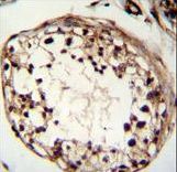 TSPYL6 Antibody immunohistochemistry of formalin-fixed and paraffin-embedded human testis tissue followed by peroxidase-conjugated secondary antibody and DAB staining.