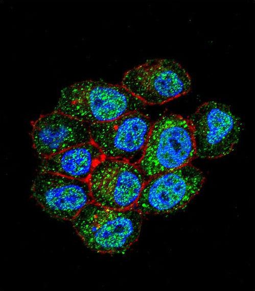 Confocal immunofluorescent of TSPYL6 Antibody with HeLa cell followed by Alexa Fluor 488-conjugated goat anti-rabbit lgG (green). Actin filaments have been labeled with Alexa Fluor555 phalloidin (red). DAPI was used to stain the cell nuclear (blue).