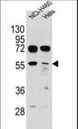 TSPYL6 Antibody western blot of NCI-H460,HeLa cell line lysates (35 ug/lane). The TSPYL6 antibody detected the TSPYL6 protein (arrow).