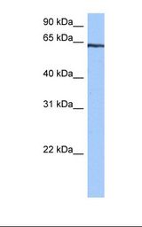 Jurkat cell lysate. Antibody concentration: 0.5 ug/ml. Gel concentration: 12%.