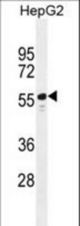 TTC6 Antibody western blot of HepG2 cell line lysates (35 ug/lane). The TTC6 antibody detected the TTC6 protein (arrow).