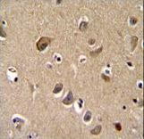 TTC9B Antibody immunohistochemistry of formalin-fixed and paraffin-embedded human brain tissue followed by peroxidase-conjugated secondary antibody and DAB staining.