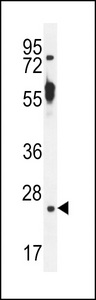 TTC9B Antibody western blot of mouse kidney tissue lysates (35 ug/lane). The TTC9B antibody detected the TTC9B protein (arrow).
