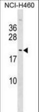 TTDN1 Antibody western blot of NCI-H460 cell line lysates (35 ug/lane). The TTDN1 antibody detected the TTDN1 protein (arrow).