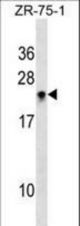 RHOH Antibody western blot of ZR-75-1 cell line lysates (35 ug/lane). The RHOH antibody detected the RHOH protein (arrow).