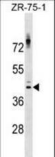 NKX2-1 Antibody western blot of ZR-75-1 cell line lysates (35 ug/lane). The NKX2-1 antibody detected the NKX2-1 protein (arrow).