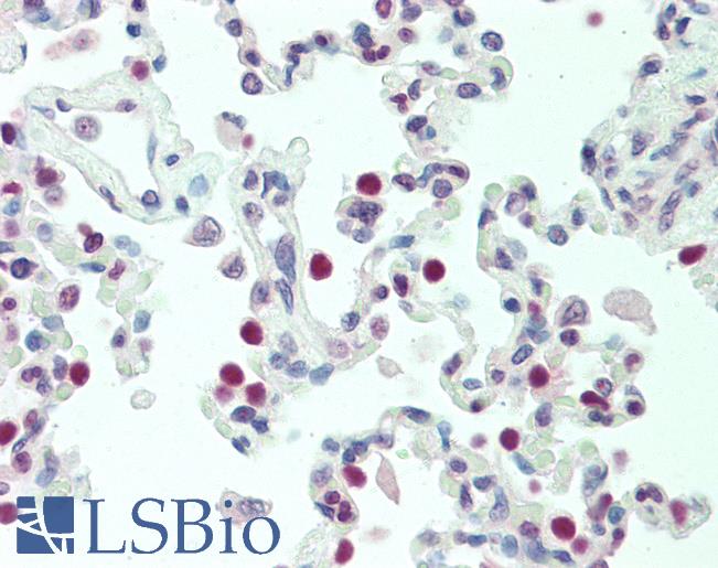 Anti-TTF1 / TTF-1 / NKX2-1 antibody IHC staining of human lung. Immunohistochemistry of formalin-fixed, paraffin-embedded tissue after heat-induced antigen retrieval. Antibody LS-B10666 dilution 1:100.