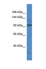 TTF1 antibody LS-C135949 Western blot of Fetal Liver lysate. Antibody concentration 1 ug/ml.