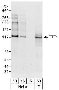 Detection of Human TTF1 by Western Blot. Samples: Whole cell lysate from HeLa (5, 15 and 50 ug) and 293T (T; 50 ug) cells. Antibodies: Affinity purified rabbit anti-TTF1 antibody used for WB at 0.04 ug/ml. Detection: Chemiluminescence with an exposure time of 30 seconds.