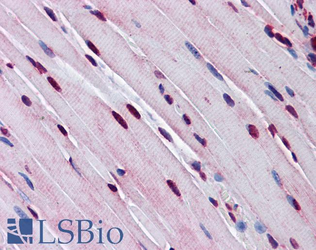 Anti-TTF1 antibody IHC of mouse skeletal muscle. Immunohistochemistry of formalin-fixed, paraffin-embedded tissue after heat-induced antigen retrieval. Antibody LS-B5631 concentration 5 ug/ml.