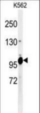 Western blot of K0406 Antibody in K562 cell line lysates (35 ug/lane). K0406 (arrow) was detected using the purified antibody.