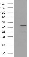 HEK293T cells were transfected with the pCMV6-ENTRY control (Left lane) or pCMV6-ENTRY TTL (Right lane) cDNA for 48 hrs and lysed. Equivalent amounts of cell lysates (5 ug per lane) were separated by SDS-PAGE and immunoblotted with anti-TTL.