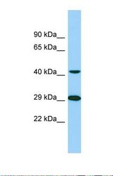 Western blot of Human 721_B. TTLL1 antibody dilution 1.0 ug/ml.