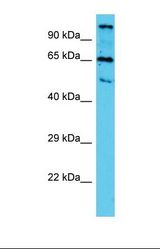 Western blot of Human HepG2. TTLL10 antibody dilution 1.0 ug/ml.