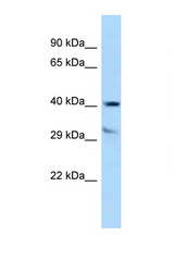 TTPA antibody LS-C146024 Western blot of Jurkat Cell lysate. Antibody concentration 1 ug/ml.