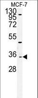 Western blot of TTPAL Antibody in MCF-7cell line lysates (35 ug/lane). TTPAL (arrow) was detected using the purified antibody.