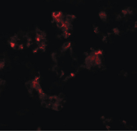Immunofluorescence of TTYH2 in human kidney tissue with TTYH2 antibody at 20 ug/ml.