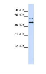 293T cell lysate. Antibody concentration: 1.0 ug/ml. Gel concentration: 12%.