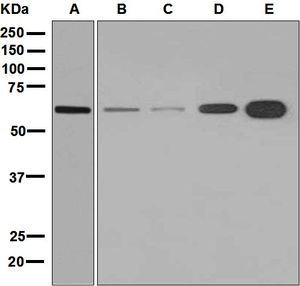 Western blot analysis on (A) SH-SY5Y, (B) Saos-2, (C) C6, (D) L6, and (E) Neuro-2a cell lysates using anti-TUB antibody.