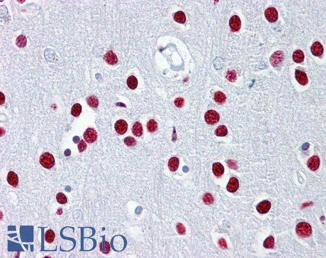 Anti-TUB antibody IHC of human brain, cortex. Immunohistochemistry of formalin-fixed, paraffin-embedded tissue after heat-induced antigen retrieval. Antibody LS-B6532 concentration 5 ug/ml.
