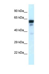 TUBA1C antibody LS-C145555 Western blot of Placenta lysate. Antibody concentration 1 ug/ml.