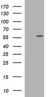 HEK293T cells were transfected with the pCMV6-ENTRY control (Left lane) or pCMV6-ENTRY TUBA1C (Right lane) cDNA for 48 hrs and lysed. Equivalent amounts of cell lysates (5 ug per lane) were separated by SDS-PAGE and immunoblotted with anti-TUBA1C.
