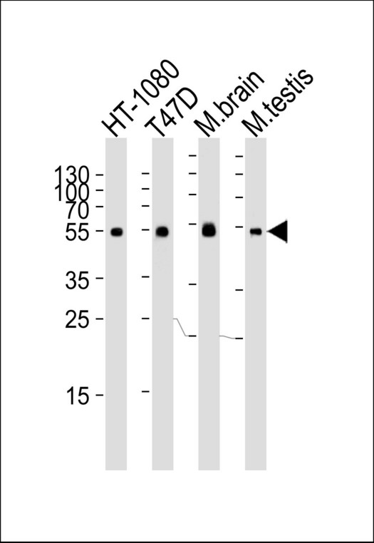 Western blot of lysates from HT-1080, T47D cell line, mouse brain and testis tissue lysate (from left to right) with TUBA1C Antibody. Antibody was diluted at 1:1000 at each lane. A goat anti-rabbit IgG H&L (HRP) at 1:5000 dilution was used as the secondary antibody. Lysates at 35 ug per lane.
