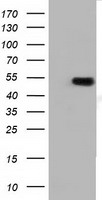 HEK293T cells were transfected with the pCMV6-ENTRY control (Left lane) or pCMV6-ENTRY TUBA3E (Right lane) cDNA for 48 hrs and lysed. Equivalent amounts of cell lysates (5 ug per lane) were separated by SDS-PAGE and immunoblotted with anti-TUBA3E.
