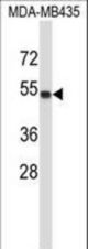 TUBA4A Antibody western blot of MDA-MB435 cell line lysates (35 ug/lane). The TUBA4A antibody detected the TUBA4A protein (arrow).