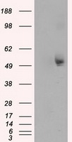 HEK293T cells were transfected with the pCMV6-ENTRY control (Left lane) or pCMV6-ENTRY TUBA8 (Right lane) cDNA for 48 hrs and lysed. Equivalent amounts of cell lysates (5 ug per lane) were separated by SDS-PAGE and immunoblotted with anti-TUBA8.