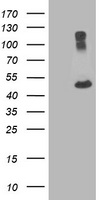 HEK293T cells were transfected with the pCMV6-ENTRY control (Left lane) or pCMV6-ENTRY TUBA8 (Right lane) cDNA for 48 hrs and lysed. Equivalent amounts of cell lysates (5 ug per lane) were separated by SDS-PAGE and immunoblotted with anti-TUBA8.