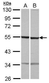 Sample (30 ug of whole cell lysate) A: NT2D1 B: U87-MG 10% SDS PAGE TUBB1 antibody diluted at 1:10000