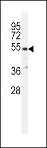 TBB1 Antibody western blot of ZR-75-1 cell line lysates (35 ug/lane). The TBB1 antibody detected the TBB1 protein (arrow).