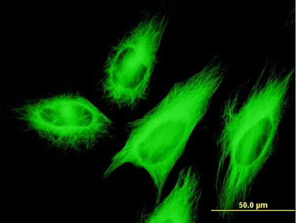 Immunofluorescence of monoclonal antibody to TUBB2A on HeLa cell. [antibody concentration 10 ug/ml].