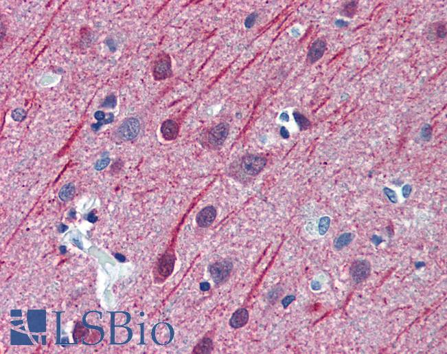 Anti-TUBB2A antibody IHC of human brain, cortex. Immunohistochemistry of formalin-fixed, paraffin-embedded tissue after heat-induced antigen retrieval. Antibody LS-B6160 concentration 2.5 ug/ml.