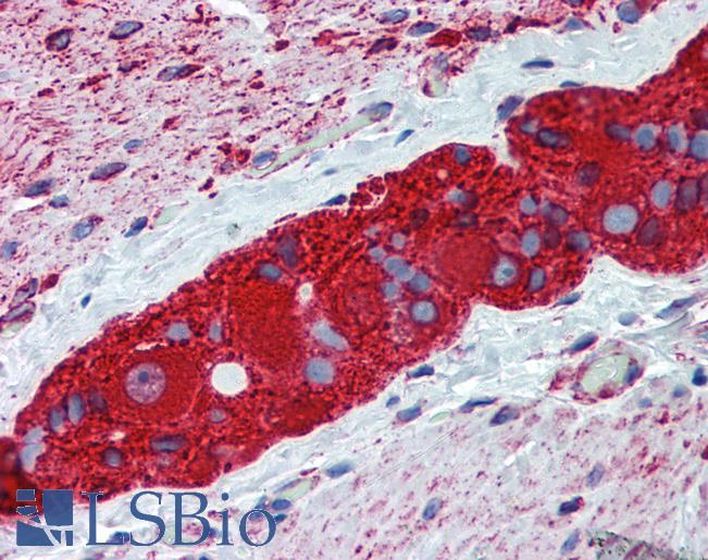Anti-TUBB2A antibody IHC of human small intestine, myenteric plexus. Immunohistochemistry of formalin-fixed, paraffin-embedded tissue after heat-induced antigen retrieval. Antibody LS-B6160 concentration 2.5 ug/ml.