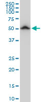 Antibody LS-B6160 Western blot of TUBB2A expression in PC-12.