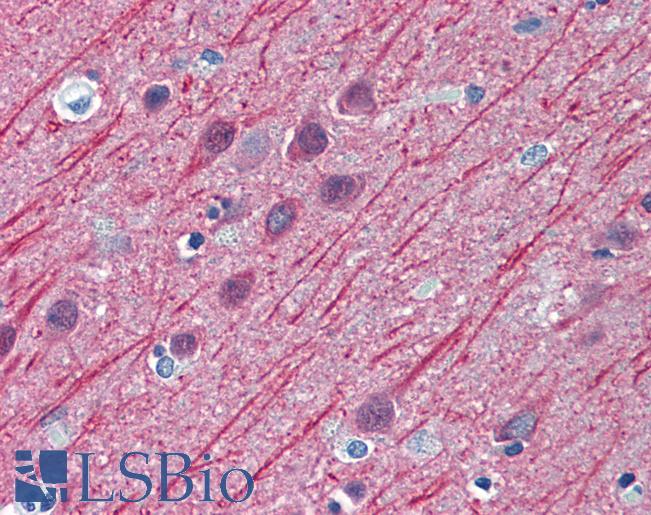 Anti-TUBB2A antibody IHC of human brain, cortex. Immunohistochemistry of formalin-fixed, paraffin-embedded tissue after heat-induced antigen retrieval. Antibody LS-B6163 concentration 2.5 ug/ml.