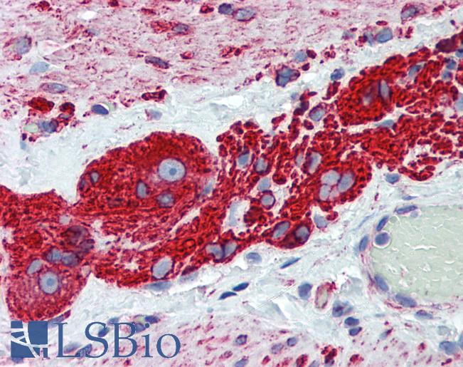 Anti-TUBB2A antibody IHC of human small intestine, myenteric plexus. Immunohistochemistry of formalin-fixed, paraffin-embedded tissue after heat-induced antigen retrieval. Antibody LS-B6163 concentration 2.5 ug/ml.