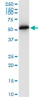Antibody LS-B6163 Western blot of TUBB2A expression in Jurkat.